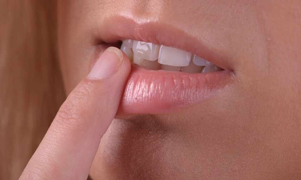 Dientes que se mueven en adultos