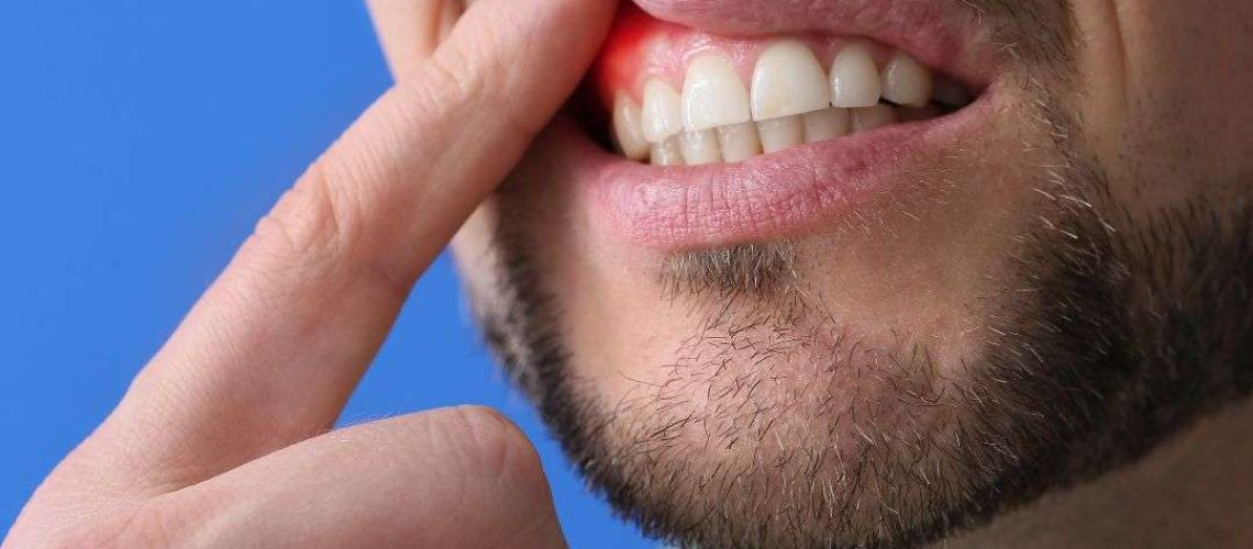 periodoncista en Málaga
