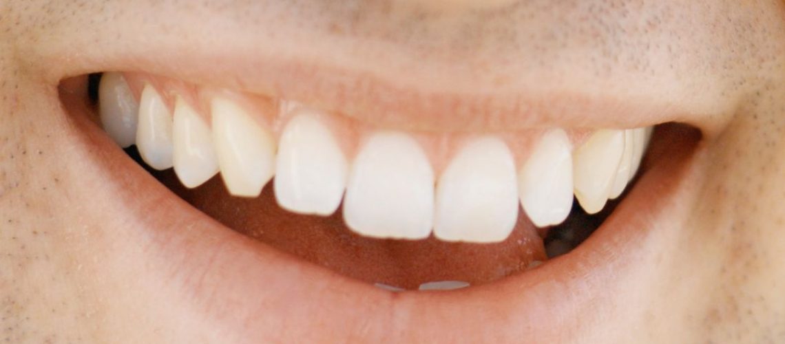 tratamientos de estética dental