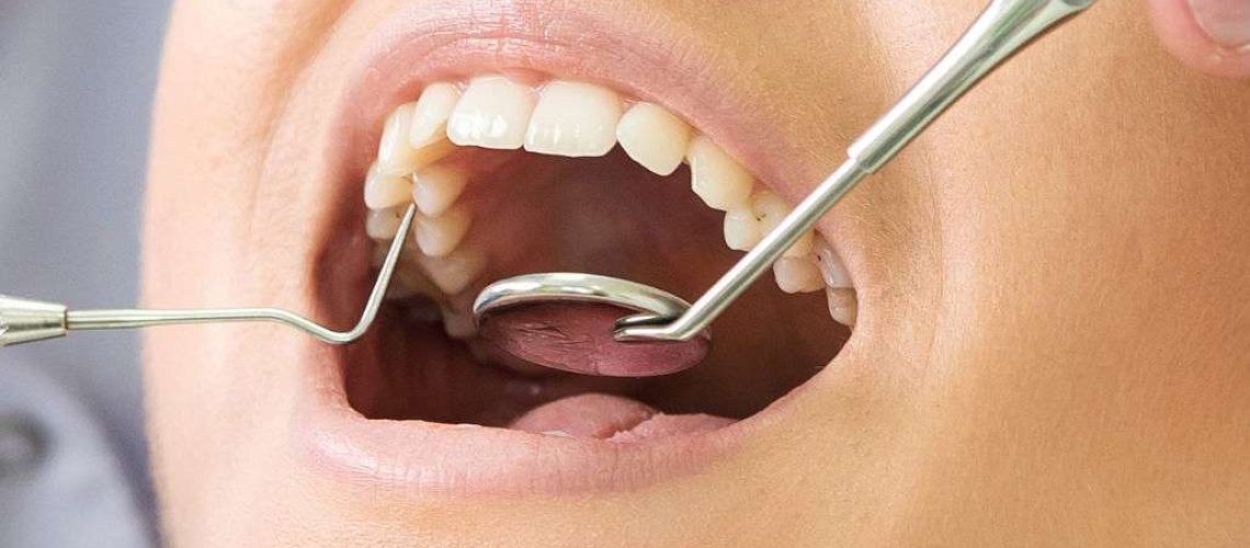 revisiones dentales