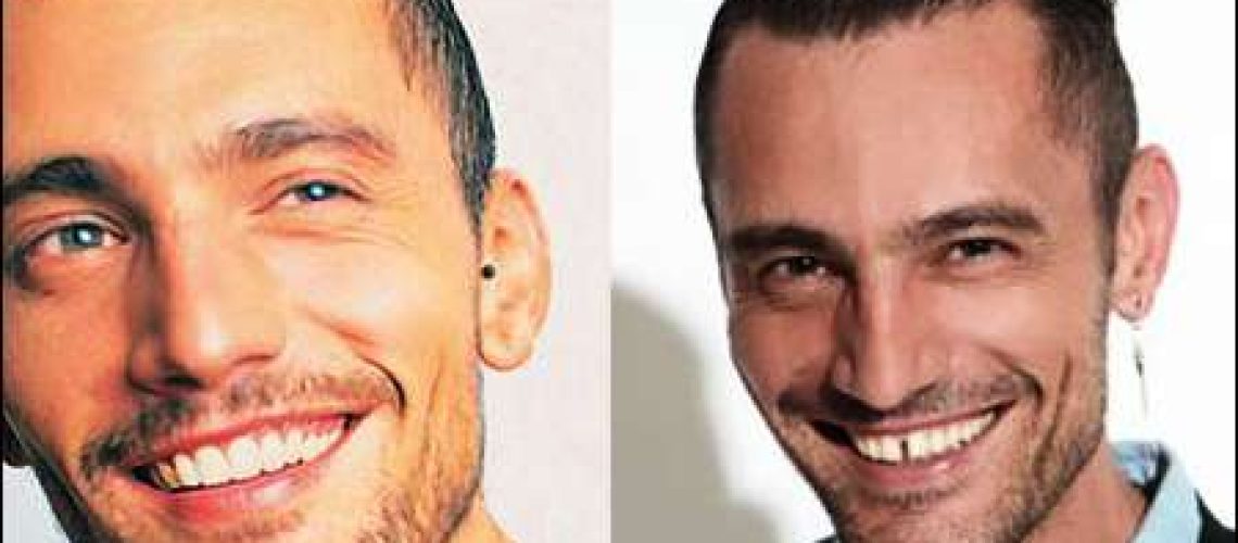 modas dentales diastema david deflin