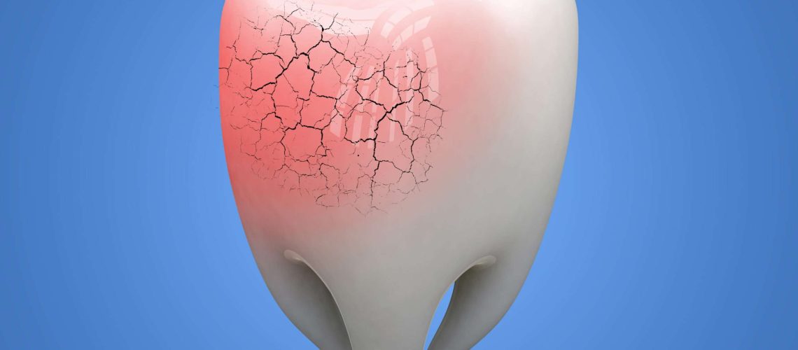 Broken human Tooth on blue background. 3d illustration.