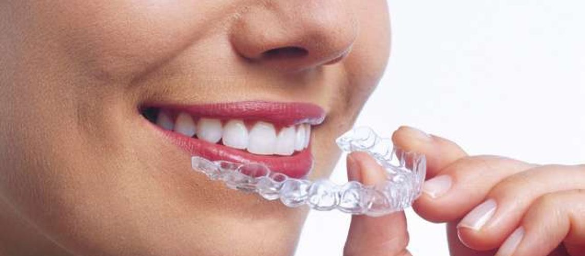 se puede comer con Invisalign