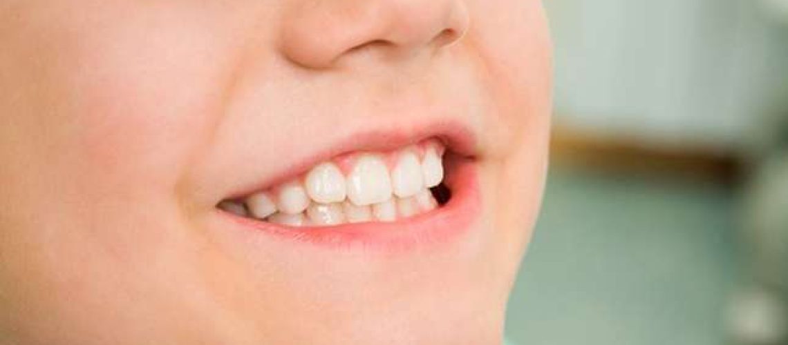 empastar los dientes de leche